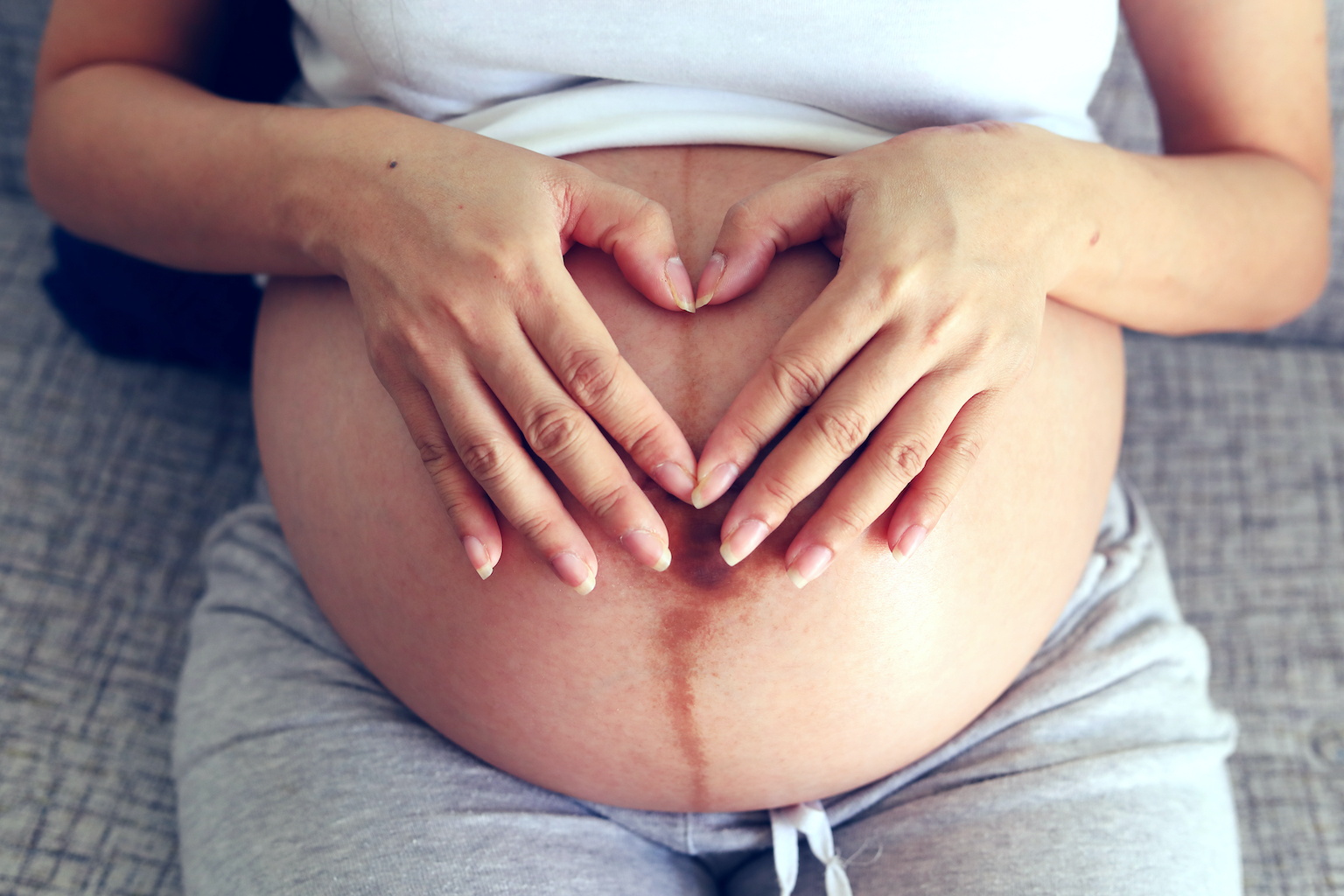 Strækmærker og andre forandringer i huden under graviditet